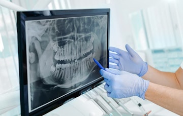 Digital dental image